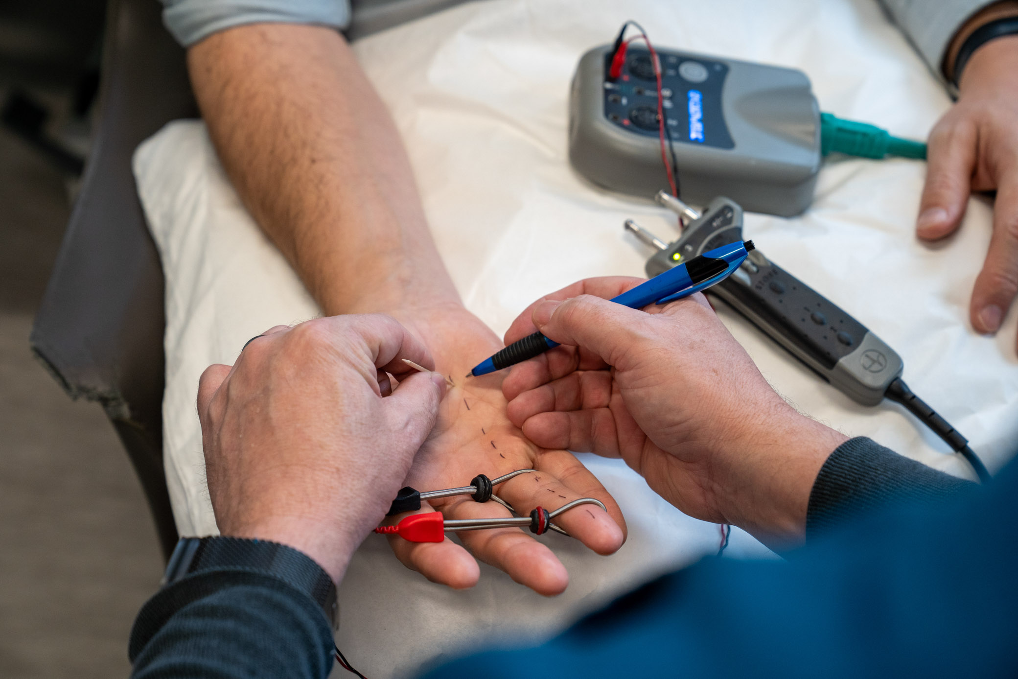 Detailed nerve conduction study of hand and fingers