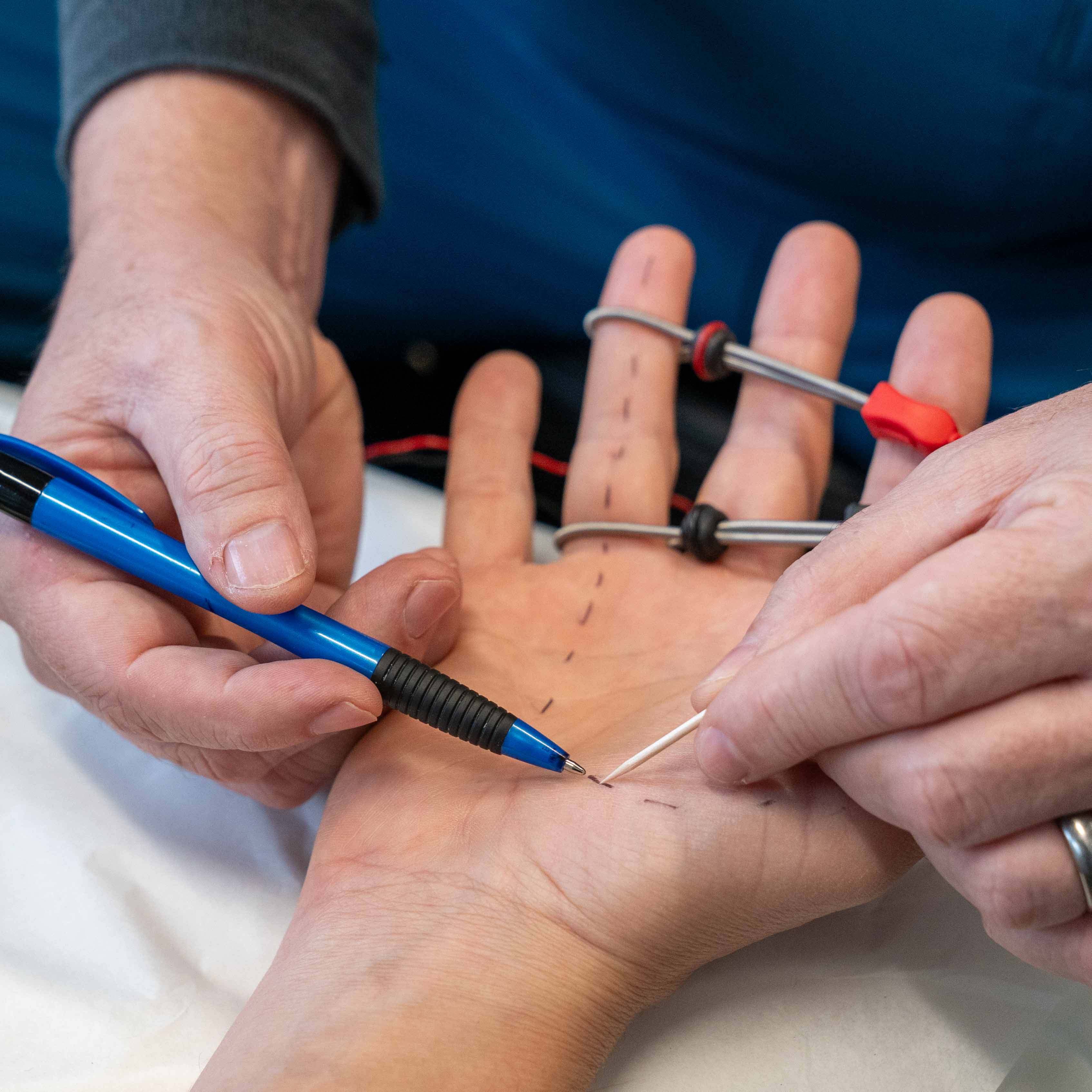 Nerve examination and sensory testing